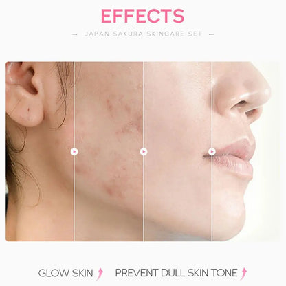 5/3pcs/Set Sakura Skin Care Sets Face Cream Serum Toner Facial Cleanser Sunscreen Eye Cream Gift Box Face Skin Care Set Product